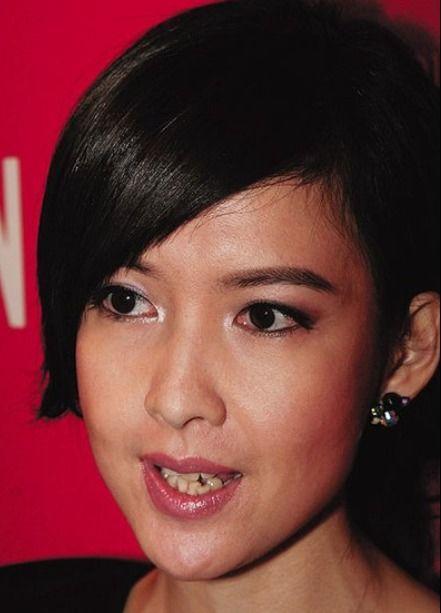 明星的牙缝,揭秘明星独特微笑背后的秘密